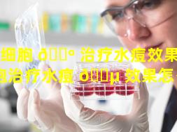 干细胞 🐺 治疗水痘效果（干细胞治疗水痘 🐵 效果怎么样）
